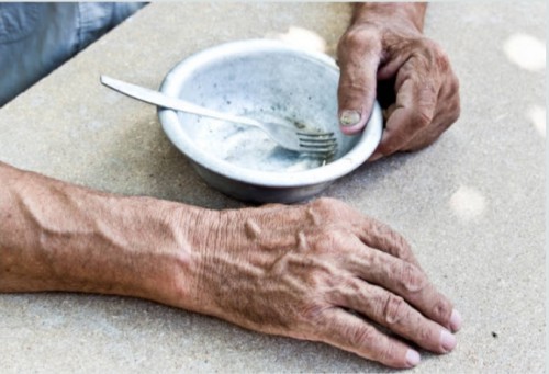 Why are vitamin and nutritional deficiencies more common in geriatrics